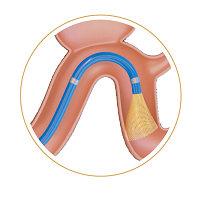 2fd8d78eeb682a3f19a78d714a91a3e